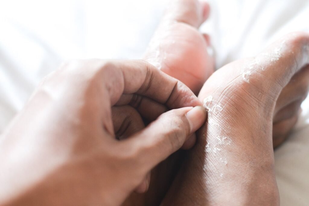 Les problèmes de peau sont une manifestation majeure d’une carence en vitamine A, de même qu’une carence en vitamine D. Les conditions dermatologiques comme le psoriasis sont souvent traitées avec des crèmes contenant cette hormone, ce qui indique que cela a un lien avec la santé de votre peau. De plus, les conditions aussi courantes que l’acné et aussi sévères que l’eczéma emploient également l’utilisation de crèmes topiques contenant de la vitamine D.