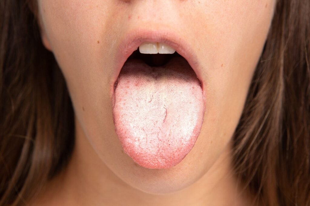 Les candidoses sont assez courantes, surtout chez les femmes qui font fréquemment face aux mycoses vaginales. Si cette candidose se situe dans la bouche, on l’appelle alors « aphte ». Cette condition est plus fréquente chez les personnes ayant un système immunitaire faible, comme les enfants et les personnes âgées. La vitamine D possède un composé anti-microbien connu sous le nom de ‘cathélicidine’, que le corps utilise pour lutter contre ces petites bêtes de candida qui produisent des maladies. Une étude récente a révélé de faibles niveaux de cette hormones chez les personnes souffrant de mycoses.