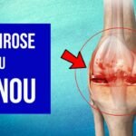 Produits NeoLife pour arthrose au Cameroun